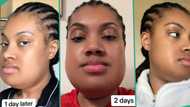 "You look amazing": Lady goes through surgery to reduce her jaw size, video gets 5.4 million views