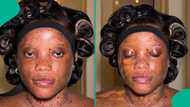 Lady shows amazing makeup transformation as artist covers her freckles: "She is beautiful"