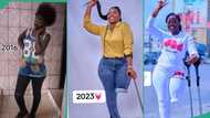 Lady shares heartbreaking throwback photo after her leg was amputated due to accident