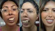 Lady with crooked teeth shows off transformation after undergoing dental surgery, video trends