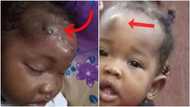 Nigerian woman cries out after daughter gets large facial scars from a surgery (photo)