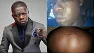 TOO BAD: Top Nigerian comedian badly brutalised by soldiers (photos)