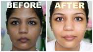 Turmeric for skin whitening: the list of natural benefits