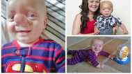 PHOTOS: Meet Baby Boy Born With His Brain Growing Into Nose