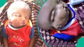 Ikon Allah: An haife jariri mai fuska 2, ido 4 a jihar Bauchi