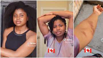 "You didn't know": Nigerian lady who thought she would be so fresh abroad shares video of her skin in Canada