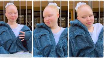 Albino lady who is extremely beautiful causes stir on TikTok as she flaunts her beauty, video Goes viral