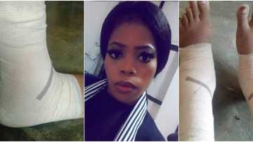 Young Nigerian lady living with sickle cell cries out for help as she needs N1m for leg ulcer treatment
