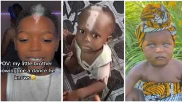 3 outstanding people who went viral because of their unique physical features