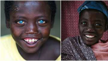 Abushe: The 14-year-old Ethiopian boy with adorable natural blue eyes everyone is talking about