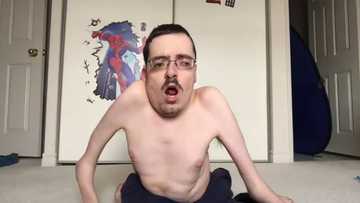 Ricky Berwick's bio: age, condition, mom, girlfriend, net worth