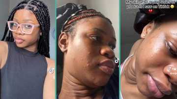 "Don't join the skincare trend": Lady displays sad transformation of face after buying skin products