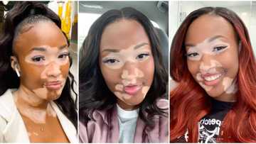 Beautiful lady shows off her unique skin, asks peeps if they would agree to marry her