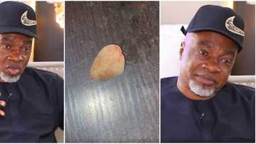 God gave me another chance: Olaiya Igwe shares near-death experience, photo of stone removed from his kidney
