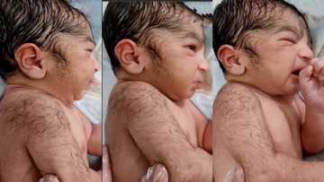 "Hairy from the first day": New born baby with so much hair on its body and face goes viral