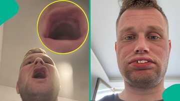UK citizen who flew to Turkey for N6 million new teeth left with none at all