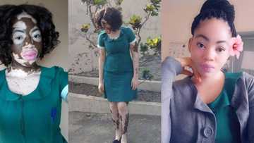 Meet stunning Ghanaian nurse whose black skin has been taken over by vitiligo (photos)