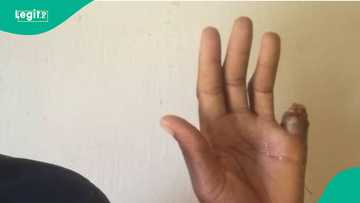 Mutumin da ya guntule yatsar shi kan Naira miliyan 80 ya yi biyu babu a Kano