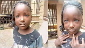 Hope for Kaosara the blue-eyed girl as Nigerians rally round her to make donations after she was rejected by dad