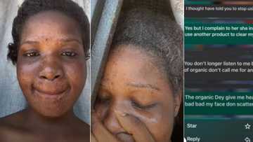 "I no longer like your face": Man breaks up with girlfriend who used organic cream to spoil her skin, chats leak