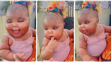 Mother steps out in streets with her amazing baby born with chubby cheeks, video goes viral