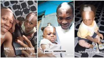 Video of cute Nigerian baby born with white frontal hairs & shiny birthmarks like the dad surfaces, wows many