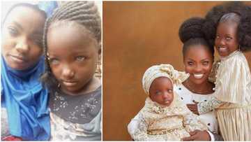 New transformation photos of woman abandoned by her husband over unique eye colour