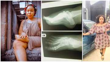 Lady born with one and half leg says she is tired of pains and injuries, begs Nigerians to help her walk again