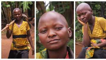 Lady, 28, with no eyebrows cries out, says her hairs stopped growing after being shaved by late dad at age 5