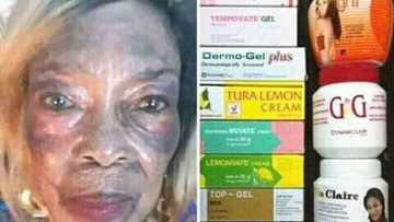 An haramta amfani da mayukan bilicin masu haskaka fata a kasar Rwanda