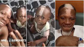 "No need for DNA test": Dad with rare white mark on face shows off son with same condition, video stuns many