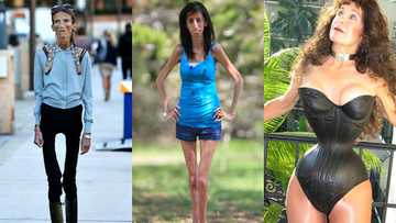 Who is the thinnest woman in the world?