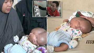 Allah Buwayi: Wata mata ta haifi jariri mai fuska 2, kwalwa 2 amma kai 1 (Hotuna)