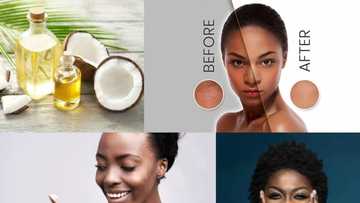 Coconut oil for skin whitening: does it work and how to use it