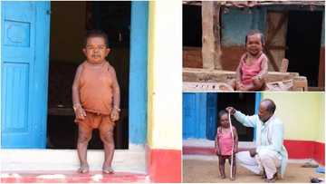 Meet 50-year-old man who stopped growing at the age of 5 (photos)