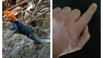 Yadda kashin kadangare ya raba wata daliba da yatsan ta guda a jihar Jigawa