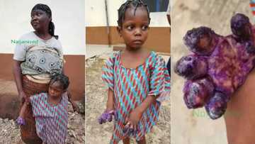 Anyiwa yarinyar da kakarta ta kona ta a jihar Edo aiki