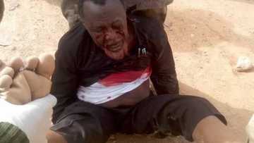 Zaria Massacre: Second Horrible Picture Of Sheikh Zakzaky Emerge (PHOTO)