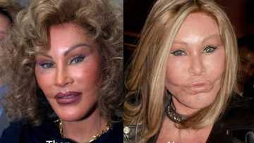 15 most outrageous celebrities' plastic surgery fails