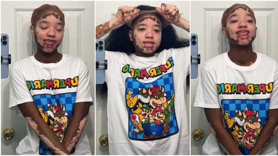 "Her skin is cute": Beautiful lady with shiny birth mark on her face goes viral, video trends on TikTok