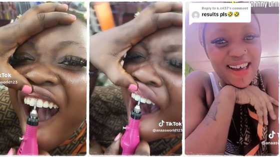 "Something God gave me for free": Lady gets artificial open teeth to look more beautiful, video goes viral