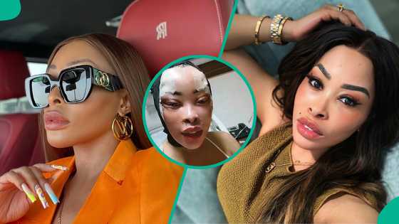 SA actress Khanyi Mabu's new look after eye surgery raises online concern: "This is sad to witness"