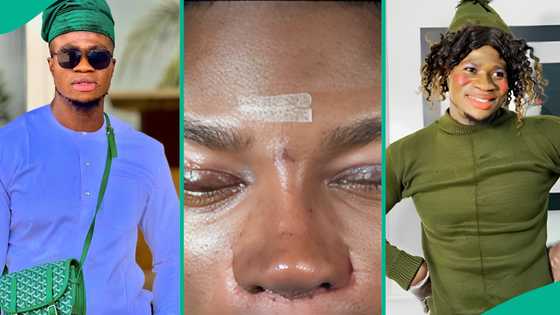 Zicsaloma reacts to news about his nose surgery, alleged cost: "Be happy they're not saying rip yet"