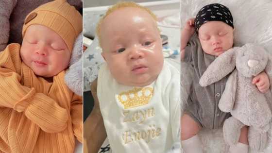 "Doctor told me he won't be an albino": Mum posts video of son with albinism, netizens gush over his cuteness