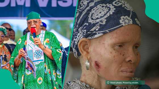 'Na sha tsangwama sosai': Gwamna ya tuna yadda ake masa ba'a ba za a zaɓi zabiya ba