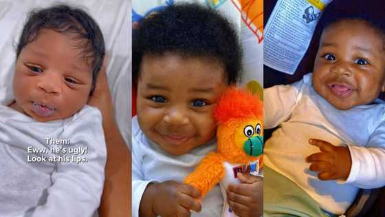 "They called him ugly": Mother shows her baby's lips after birth, transformation video goes viral on TikTok