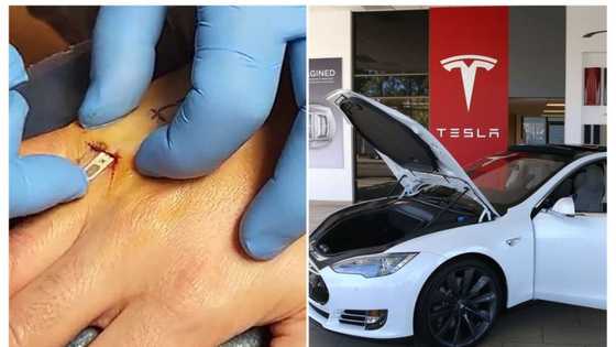 Tesla car owner gets N264,000 car key implant in his hand over Bluetooth problem