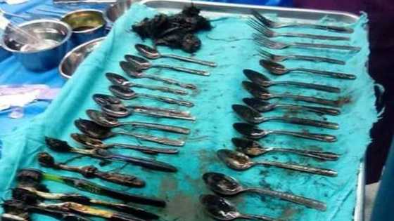 Tashin hankali: Likitoci sun ciro cokula guda 24 a cikin wani mutumi marar lafiya