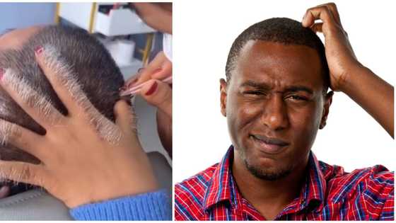 "Why not dye the hair": Mixed reactions to video of man undergoing gray hair removal