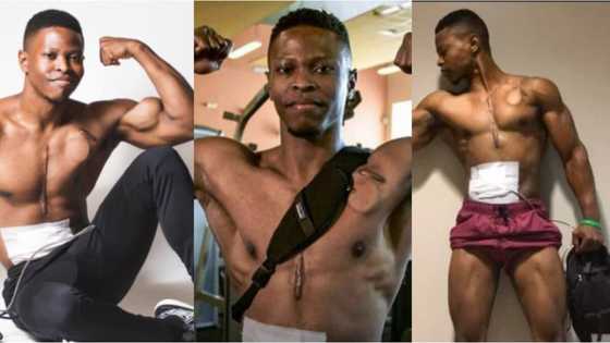 Meet fitness model who walked with an artificial heart in his backpack for over 2 years